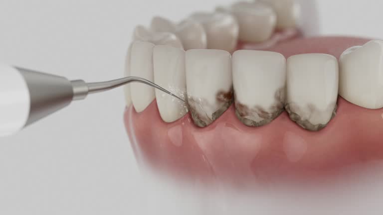 Reliable Dental contractor in Sparta, WI by Smile Center Dentistry
